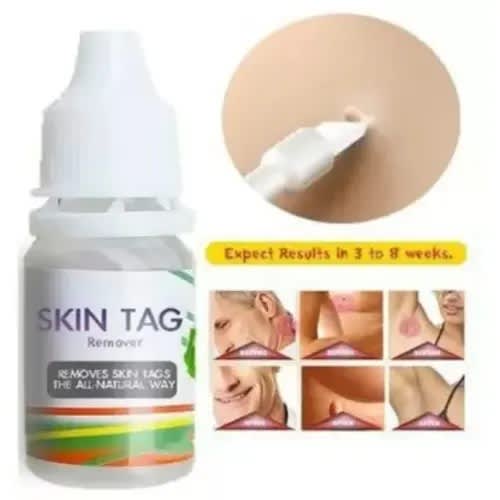 Skin Tag Remover