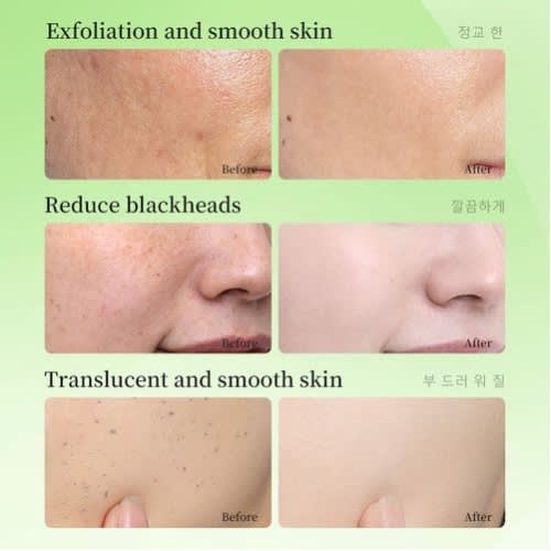 Whitening Exfoliating Gel For Deep Cleansing And Radiant Glowing Skin - 7day Visible Results-60g