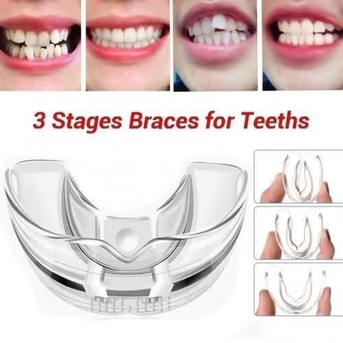 3 Stages Teeth Corrector - Brace Invisible Aligner
