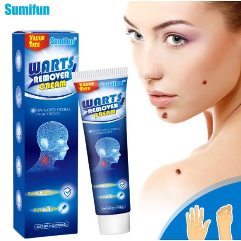 Effective Wart Remover Cream/ Skin Tag Remover 60g