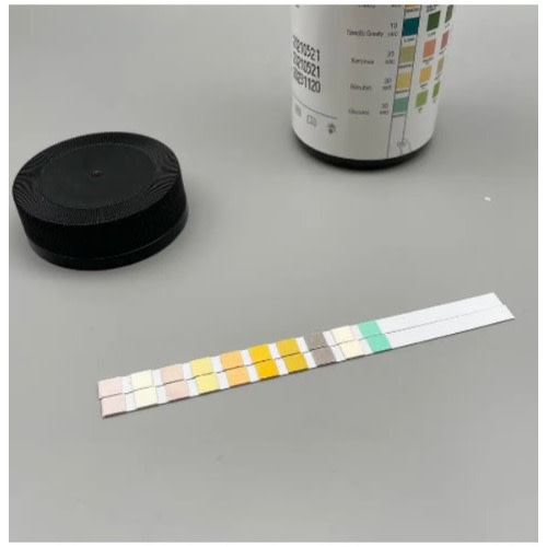 Test Strip For Urine Urinalysis