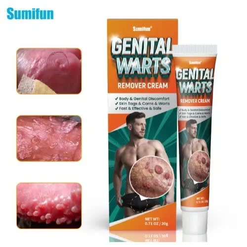 Genital Wart Removal Cream - 20g