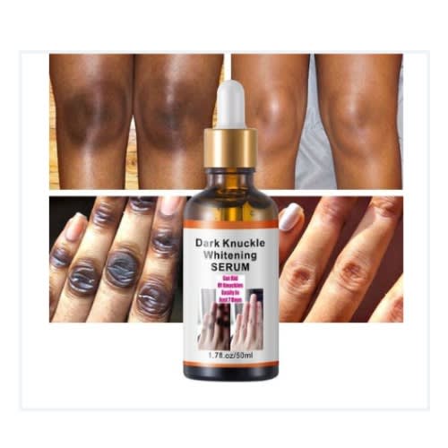 Dark Spot Remover - Magic Dark Knuckle Remover - 50ml