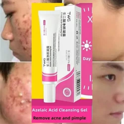 Azelaic Acid Cleansing Gel 15% - 30ml