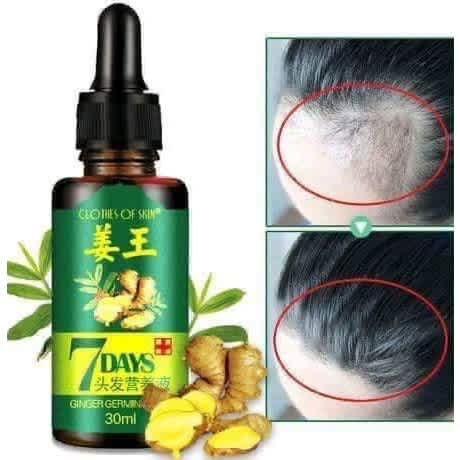 7-days Magic Ginger Germinal Oil Hair Growth- Bald Head Treatment - 30ml